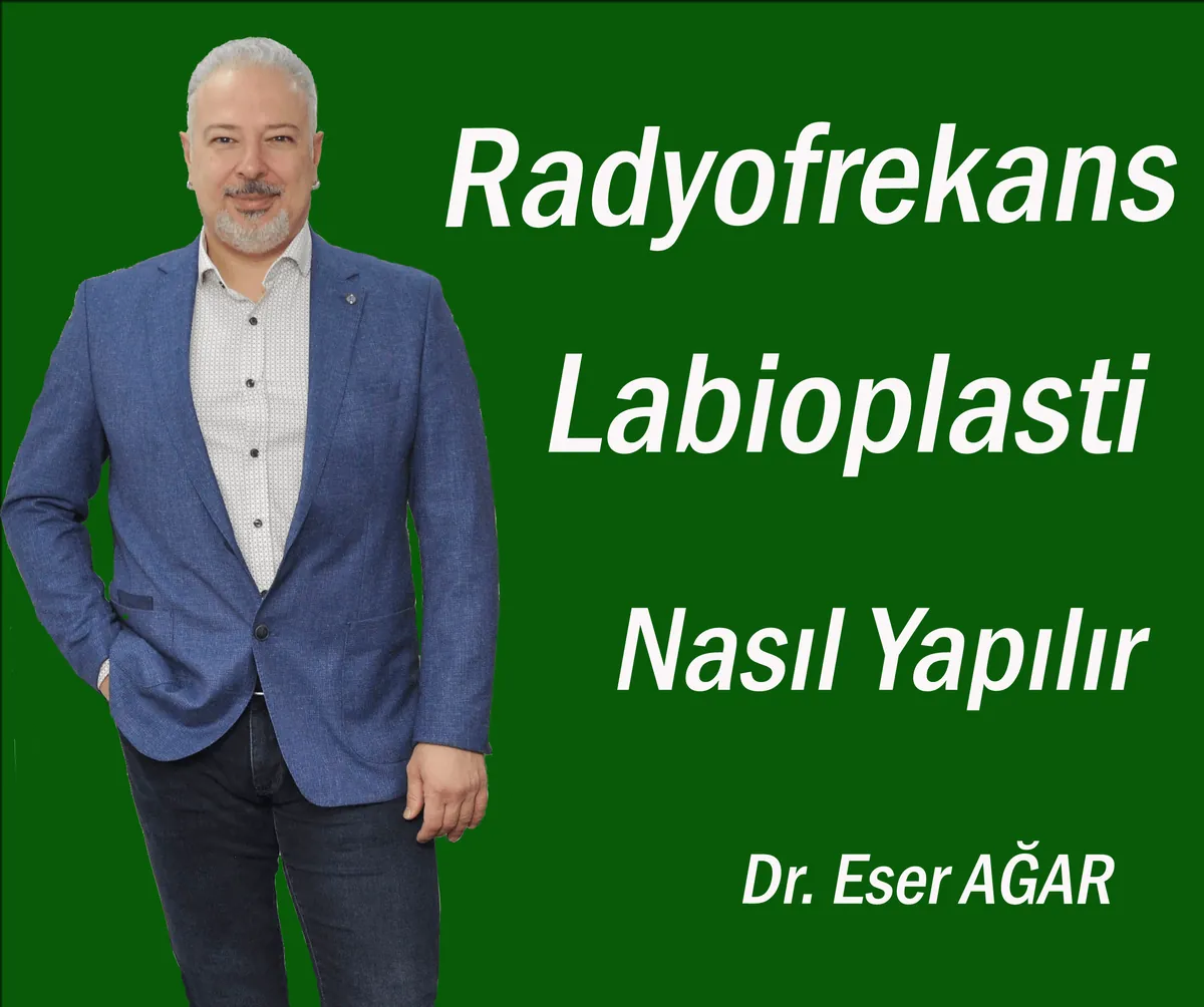 Video kapağı