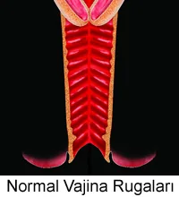 Normal vajina şematik gösterim