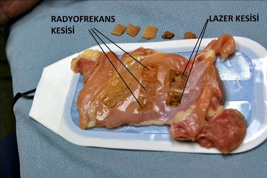 Radyofrekans kesisi ile lazer kesisinin doku üzerinde karşılaştırması